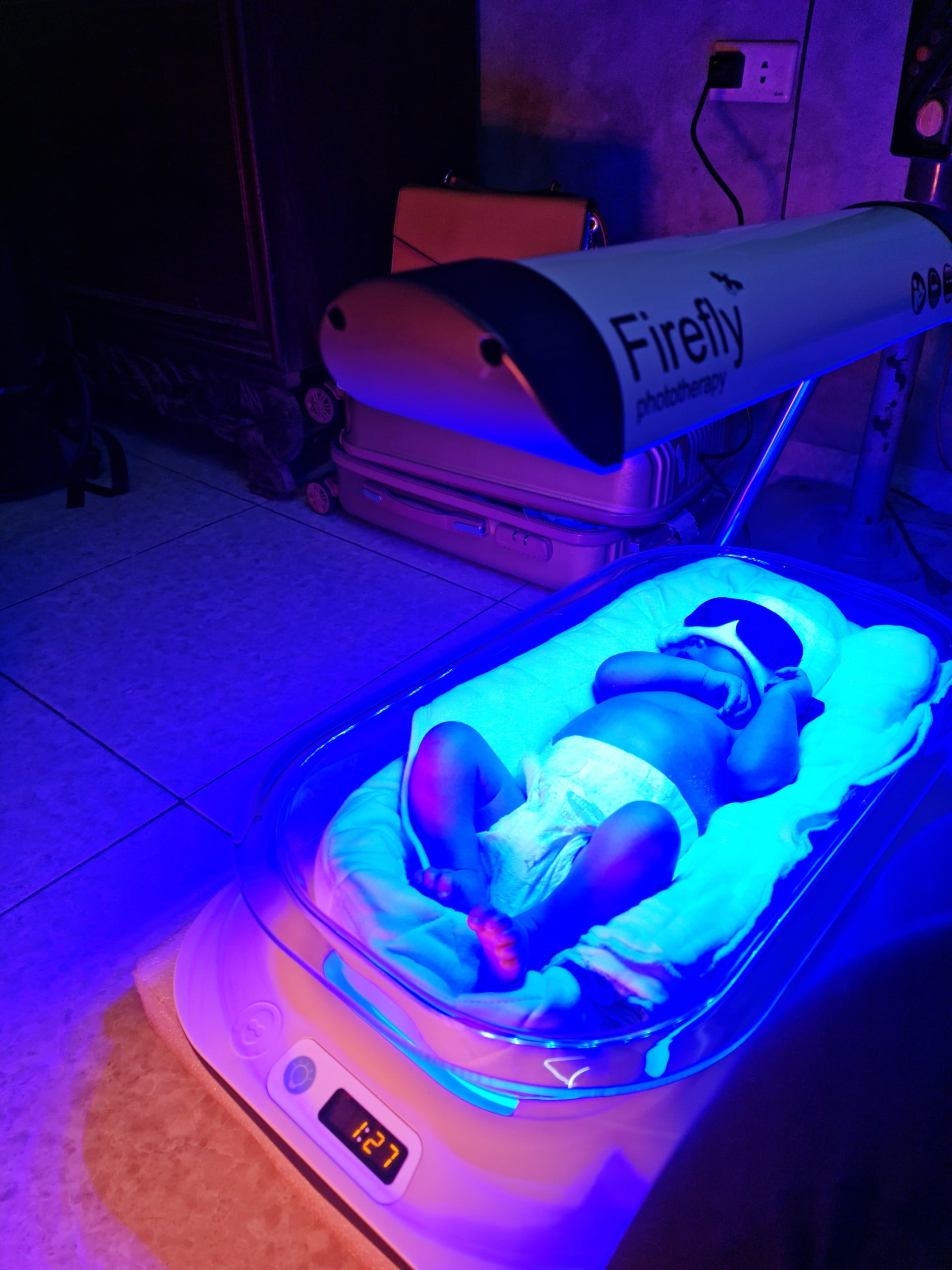 Chiếu đèn điều trị vàng da cho trẻ sơ sinh tại nhà