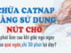 chua-catnap-bang-su-dung-nut-cho